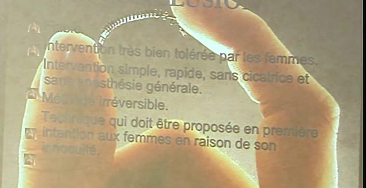 Implant Essure, une technique de stérilisation préconisée dès 2007 | INA