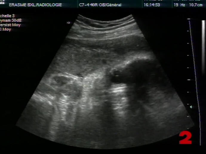 elfbar nachfüll pod läuft aus Cigarette électronique Femme Enceinte main image 0